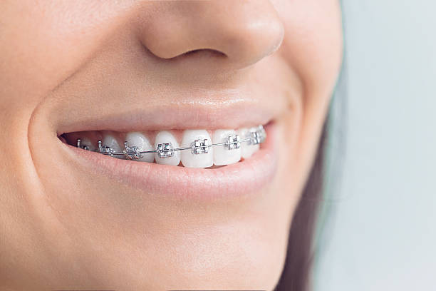Best Dental Fillings (Composite and Amalgam)  in Keego Harbor, MI